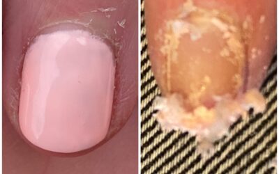 Caviar Quick Fix 5min Gel Remover